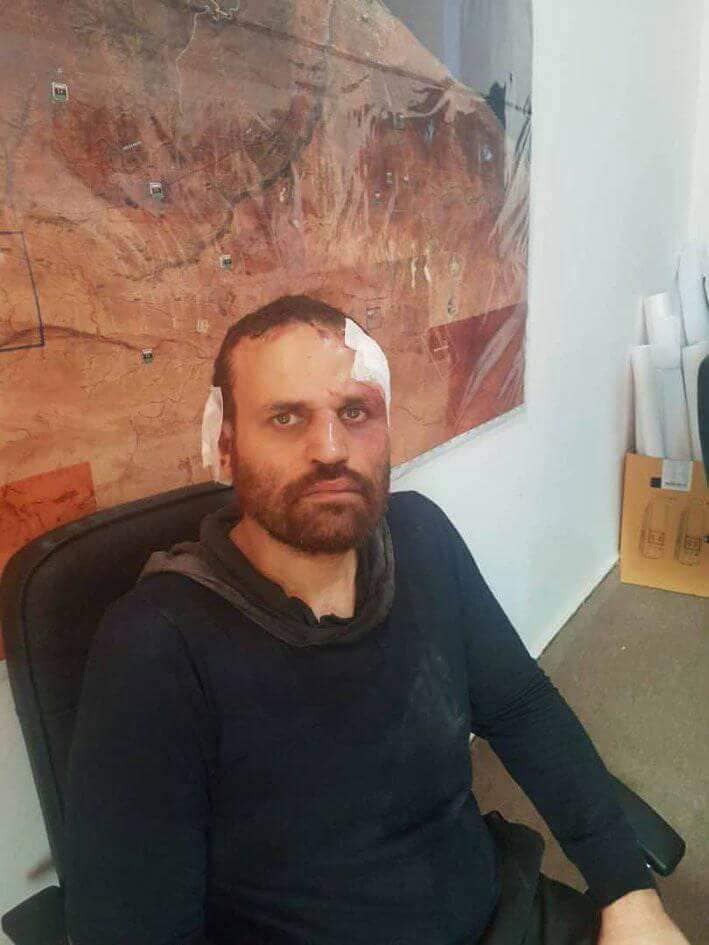 Libya- LNA photos showing Hisham Ashmawy in custody. Most wanted militant in Egypt, former military officer who defected and eventually ended up with al-Qaeda in Libya, Ashmawy was reportedly arrested in Derna wearing an explosive vest that he failed to detonate   